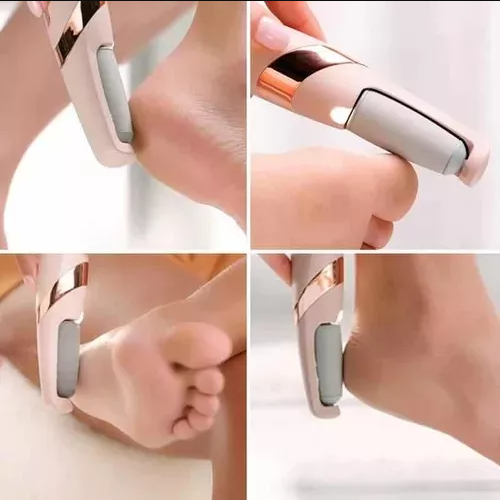 FeetPeeler – Elimina durezas sin esfuerzo – Siente tus pies suaves y ligeros desde el primer uso
