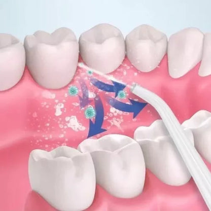 Irrigador HydroSmile  - Limpieza bucal en 5 minutos
