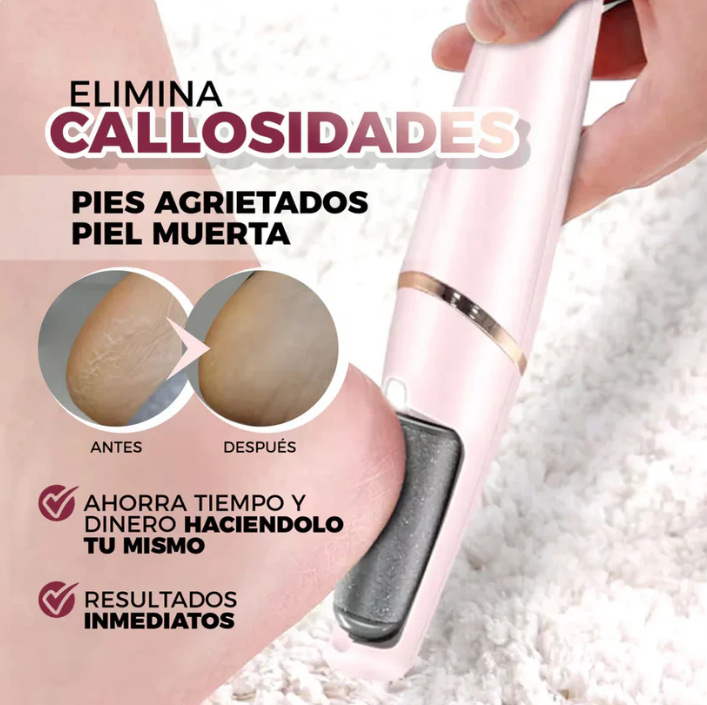 FeetPeeler – Elimina durezas sin esfuerzo – Siente tus pies suaves y ligeros desde el primer uso
